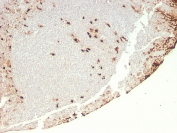 Recombinant Granulocyte-Colony Stimulating Factor Antibody / CSF3