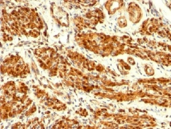 Calponin Antibody