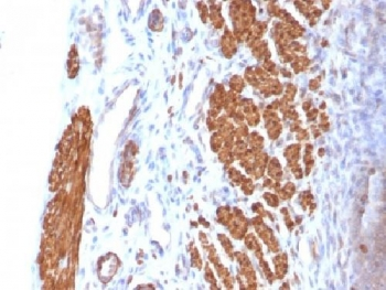 Calponin Antibody