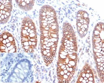 Recombinant Cadherin 1 Antibody / CDH1 / E-Cadherin