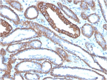 Cadherin 1 Antibody / CDH1 / E-Cadherin