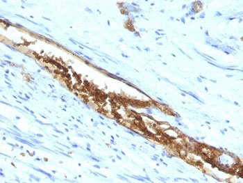 ABO Antibody / Blood Group Antigen A