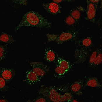 B7-H4 Antibody / VTCN1