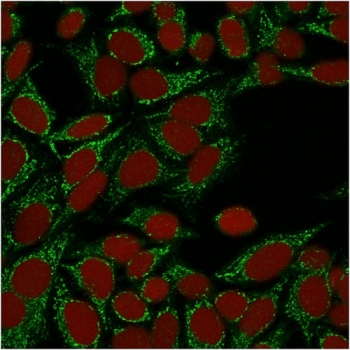 Galectin 1 Antibody