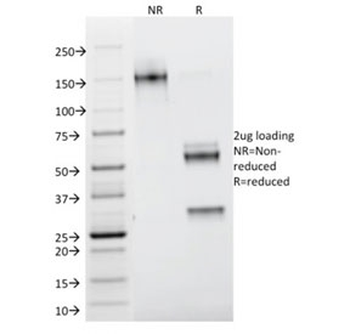 Galectin 1 Antibody