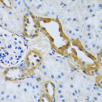 SLC4A5 Antibody