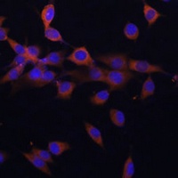 PPP3R1 Rabbit Polyclonal Antibody