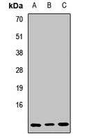 Sm F Rabbit Polyclonal Antibody