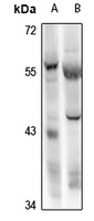 RBPJL Rabbit Polyclonal Antibody