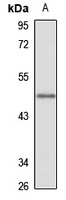 CIR Rabbit Polyclonal Antibody