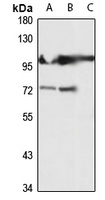 GCK Rabbit Polyclonal Antibody