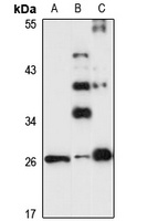 TRH Rabbit Polyclonal Antibody