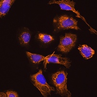 TRH Rabbit Polyclonal Antibody