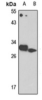 TRH Rabbit Polyclonal Antibody