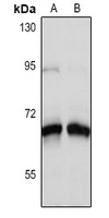 SLC18A3 Rabbit Polyclonal Antibody