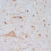 SLC18A3 Rabbit Polyclonal Antibody