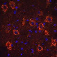 SLC18A3 Rabbit Polyclonal Antibody