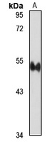 Brachyury Rabbit Polyclonal Antibody