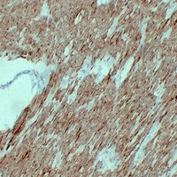Actin Muscle Specific Mouse Monoclonal Antibody