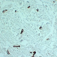 alpha Smooth Muscle Actin Mouse Monoclonal Antibody