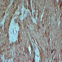 alpha Smooth Muscle Actin Mouse Monoclonal Antibody