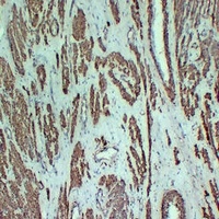alpha Smooth Muscle Actin Mouse Monoclonal Antibody