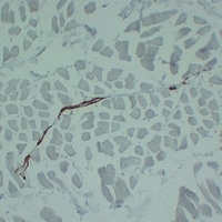 alpha Smooth Muscle Actin Mouse Monoclonal Antibody
