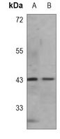 BMI1 Mouse Monoclonal Antibody