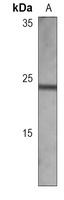 MGMT Mouse Monoclonal Antibody