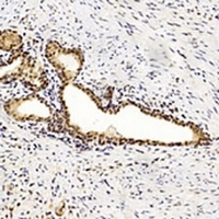 MGMT Mouse Monoclonal Antibody