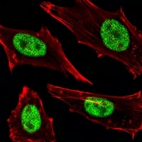 MGMT Mouse Monoclonal Antibody
