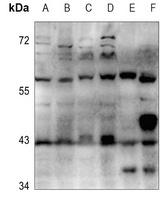 Cytochrome P450 3A4/5 Rabbit Polyclonal Antibody