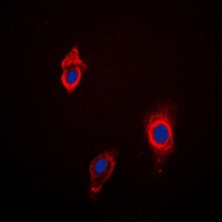 Cytochrome P450 3A4/5 Rabbit Polyclonal Antibody