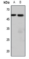 Endothelin A Receptor Rabbit Polyclonal Antibody