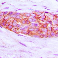 Endothelin A Receptor Rabbit Polyclonal Antibody
