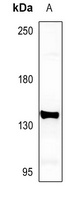 mGLUR5 Rabbit Polyclonal Antibody