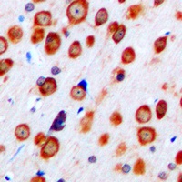 mGLUR5 Rabbit Polyclonal Antibody