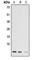 Histone H4 (Acetyl-K12) Rabbit Polyclonal Antibody