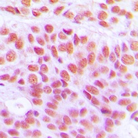 Histone H4 (Acetyl-K12) Rabbit Polyclonal Antibody