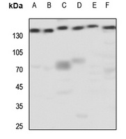 mGLUR5 Rabbit Polyclonal Antibody