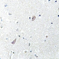 mGLUR5 Rabbit Polyclonal Antibody
