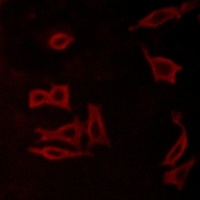 mGLUR5 Rabbit Polyclonal Antibody