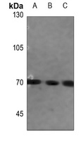 FATP5 Rabbit Polyclonal Antibody