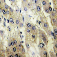 FATP5 Rabbit Polyclonal Antibody