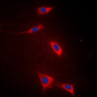FATP5 Rabbit Polyclonal Antibody