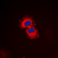 ZAK Rabbit Polyclonal Antibody