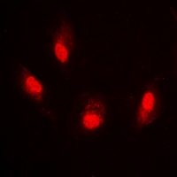 Histone H4 (Acetyl-K8) Rabbit Polyclonal Antibody