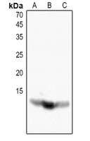 Histone H4 (Acetyl-K16) Rabbit Polyclonal Antibody