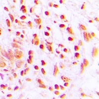 Histone H4 (Acetyl-K16) Rabbit Polyclonal Antibody
