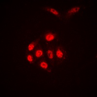 Histone H4 (Acetyl-K16) Rabbit Polyclonal Antibody